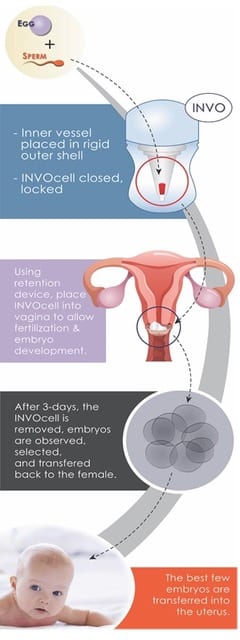 INVO-Procedure