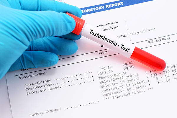 Testosterone levels