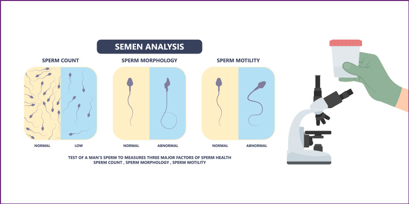 semen analysis