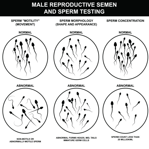 semen analysis under microscope