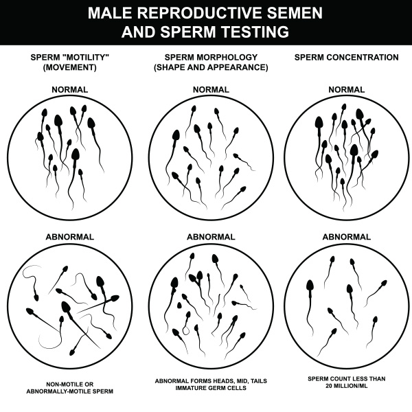 semen analysis under microscope semen analysis under microscope