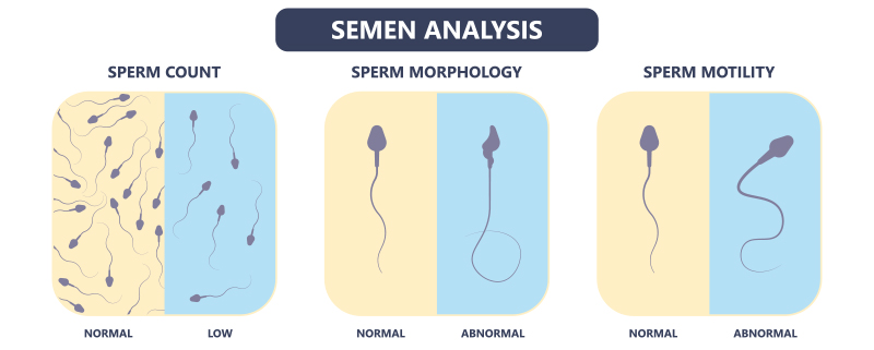 semen analysis