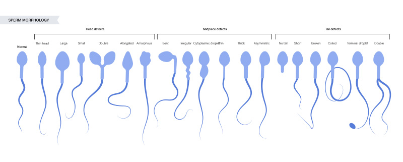 sperm morphology