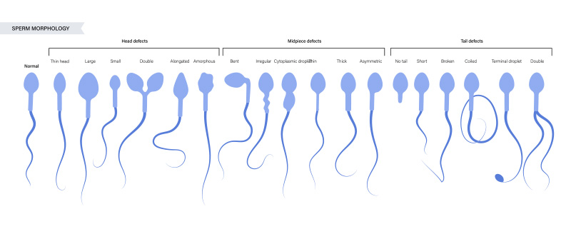 sperm morphology sperm morphology