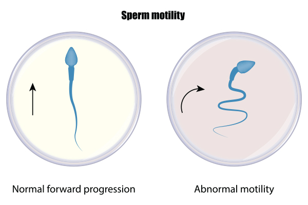sperm motility sperm motility
