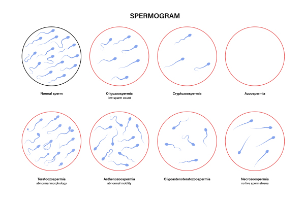 spermogram
