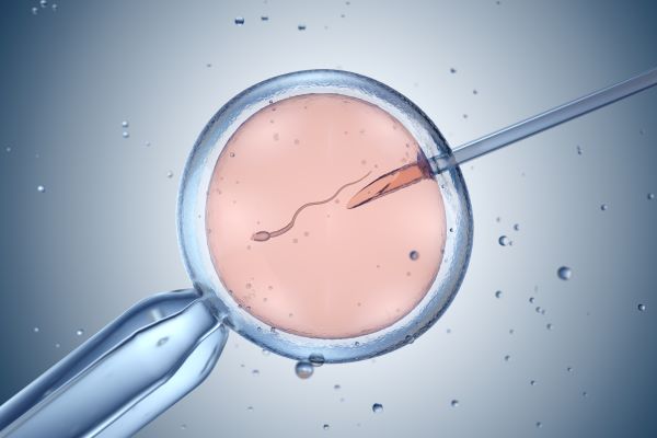What is IVF What is IVF